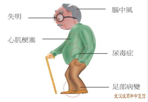 武汉武汉火车站有个疑难杂症中医：老年人出汗进食后加重伴口干多饮眠差怎么调？